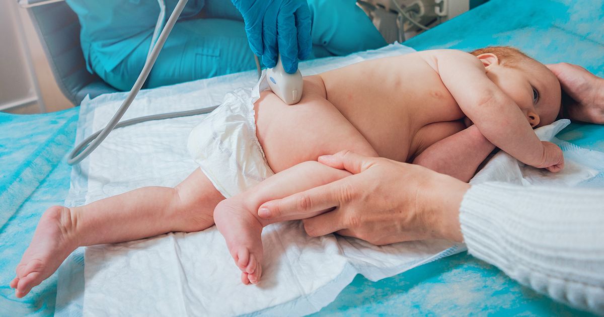 USG vyšetrenie bedrových kĺbov novorodencov